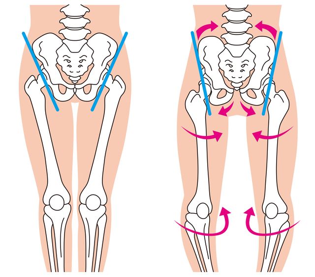 股関節の変形