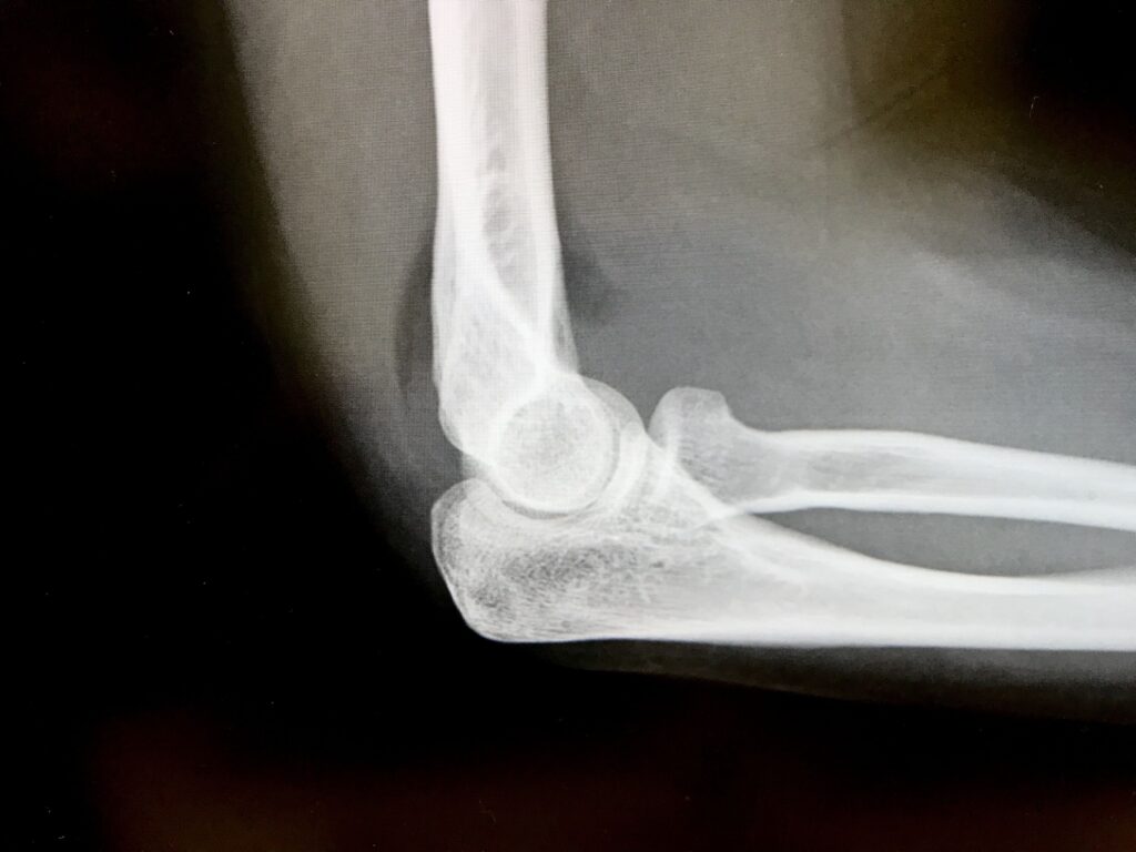 レントゲン検査