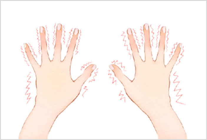 神経性によるもの