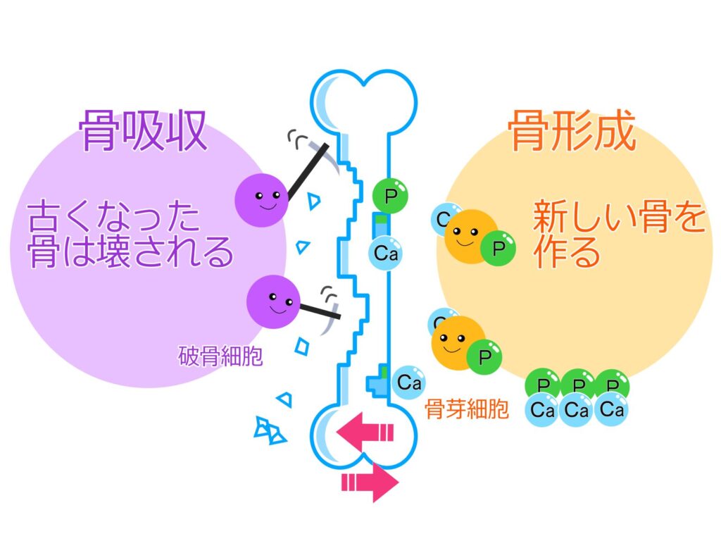 腰骨粗鬆症になる原因