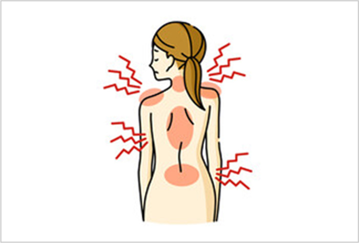椎間板の変性で起こる神経の圧迫