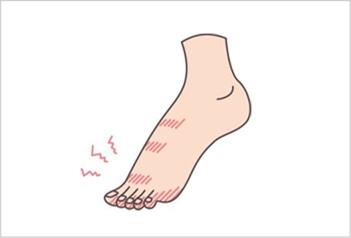 糖尿病や動脈硬化症などで起こる
下肢（脚）の血流悪化