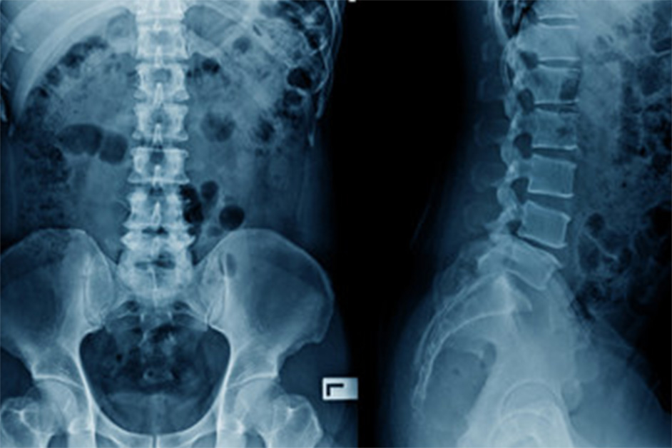 レントゲン検査